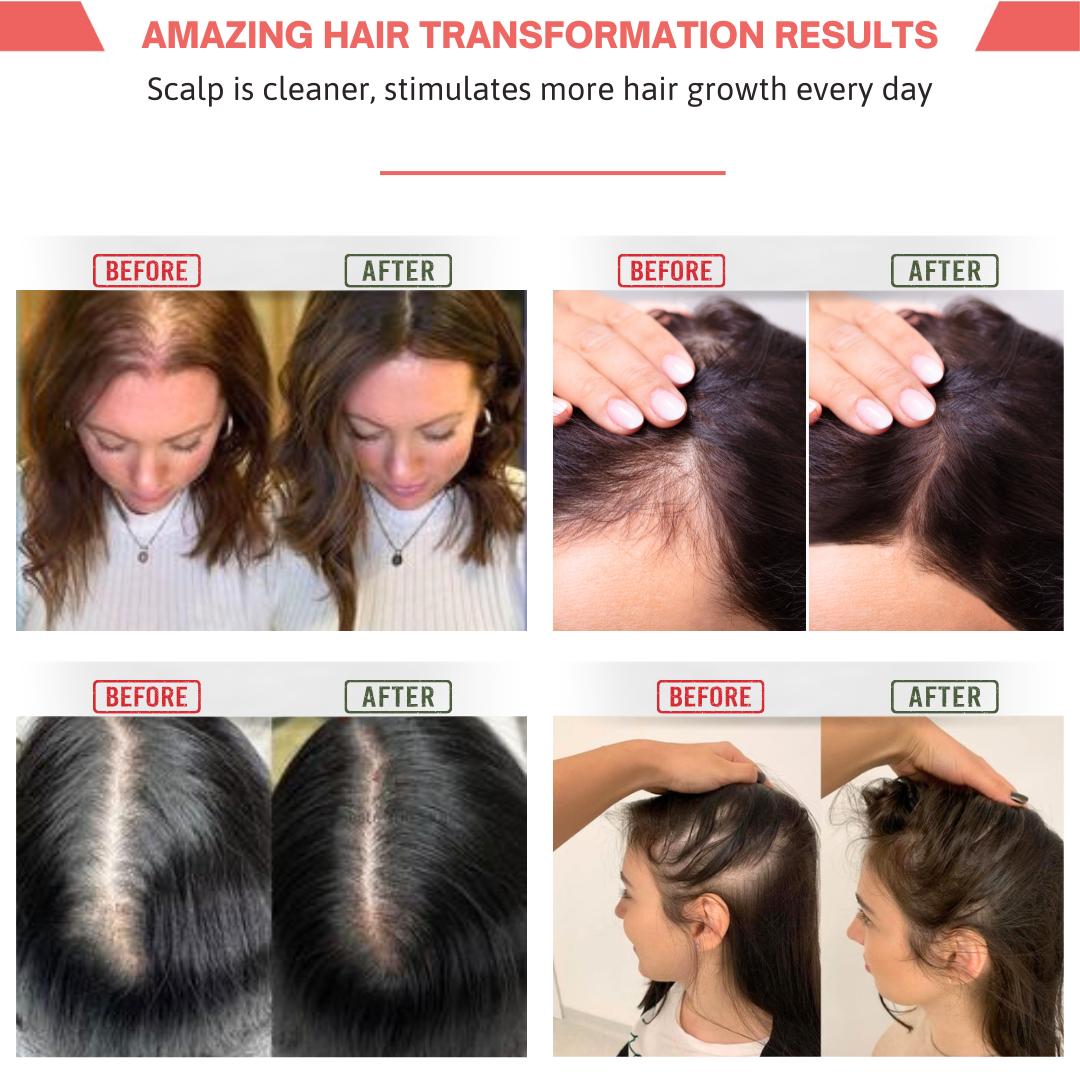 SelinaPro™ The Natural 4 in 1 Restoration Brush
